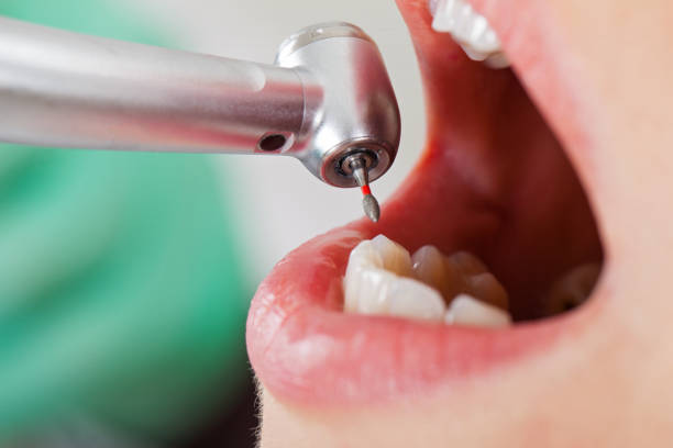 Best Emergency Treatment for Oral Infections in Bowmanstown, PA